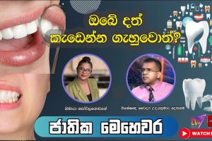 ඔබේ දත් කැ‌ඩෙන්න ගැහුවොත් ? - විශේෂඥ වෛද්‍ය උදයකුමාර දෙනගම - ජාතික මෙහෙවර